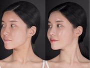 Antes e depois